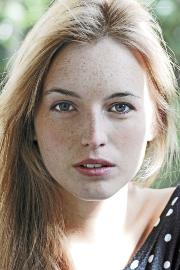 Chicks with cute freckles