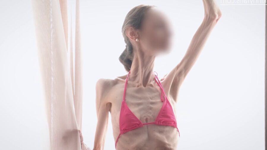 Gina - os maigres et fragiles anorexiques duenn knochig