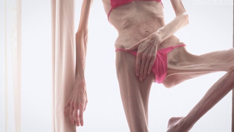 Gina - os maigres et fragiles anorexiques duenn knochig