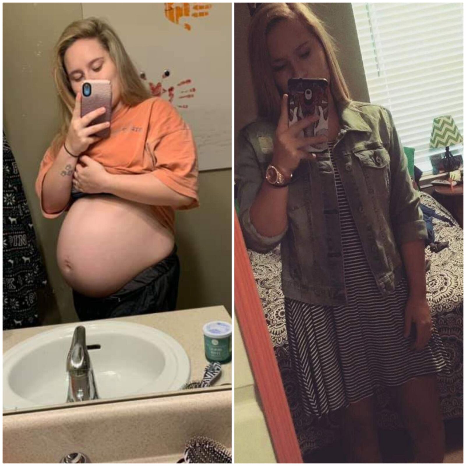 Pregnant teens - before and after 5