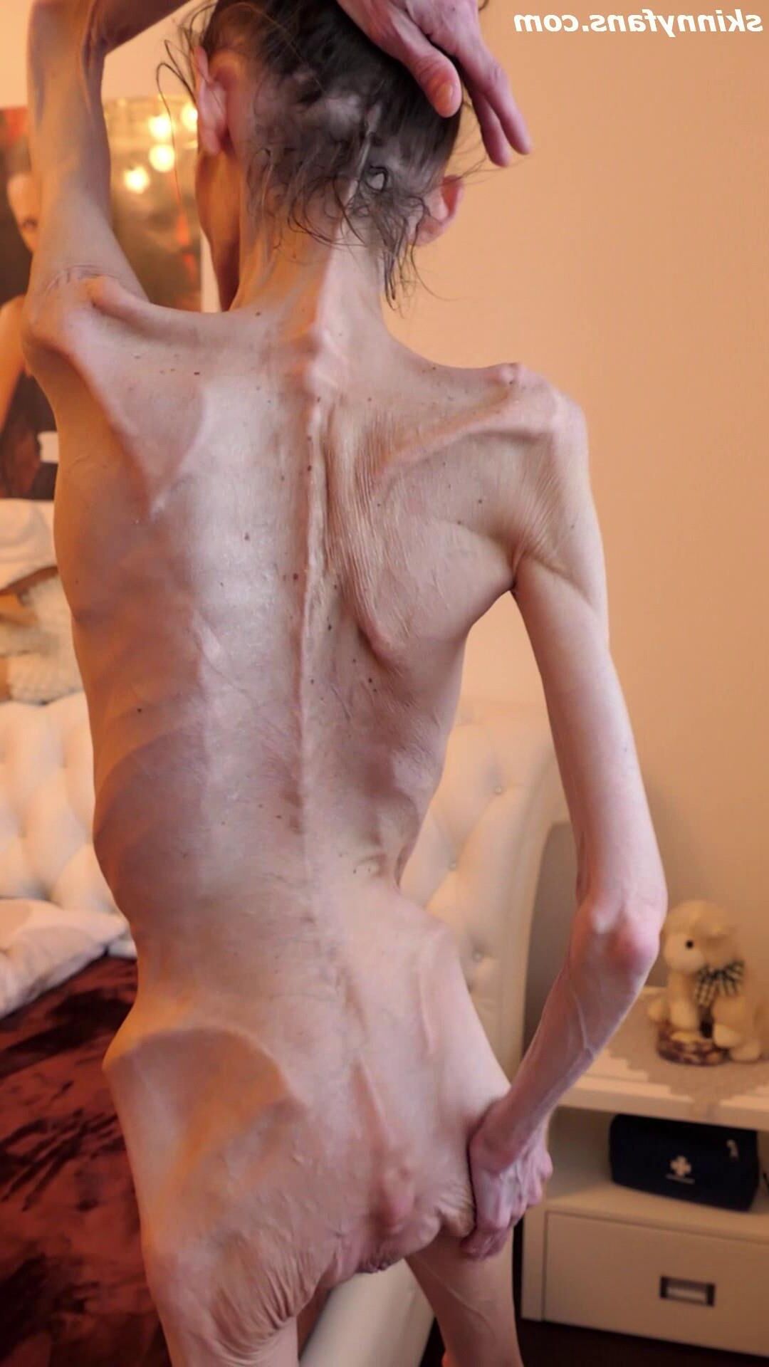 Denisa anoréxica flaca frágil mager duenn knochig huesos