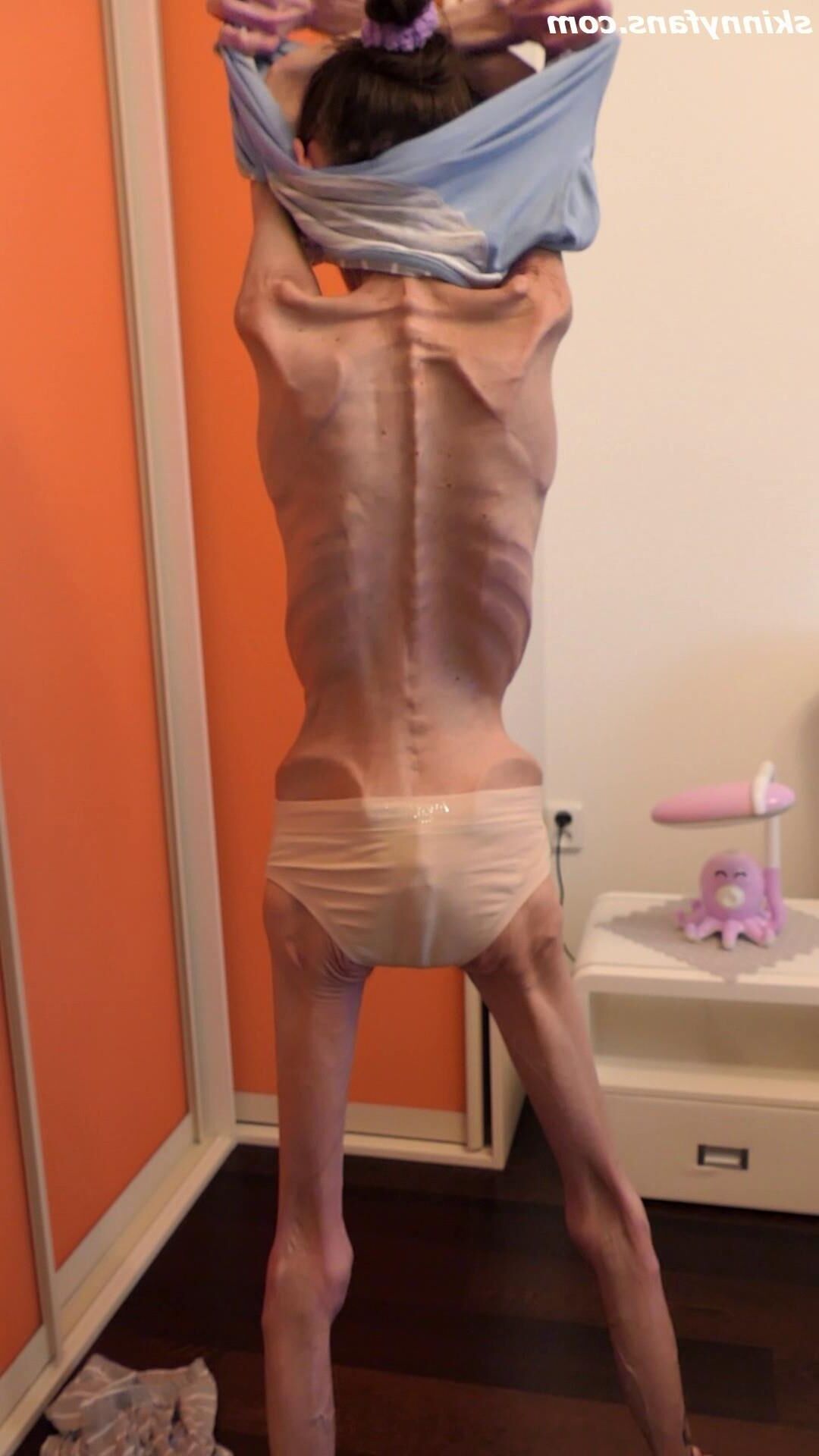 Denisa anoréxica flaca frágil mager duenn knochig huesos