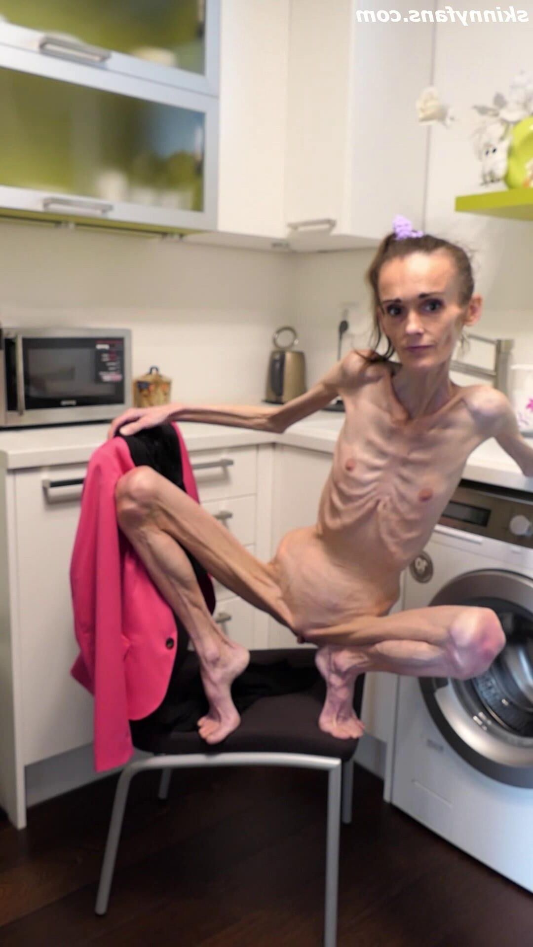 Denisa anoréxica flaca frágil mager duenn knochig huesos