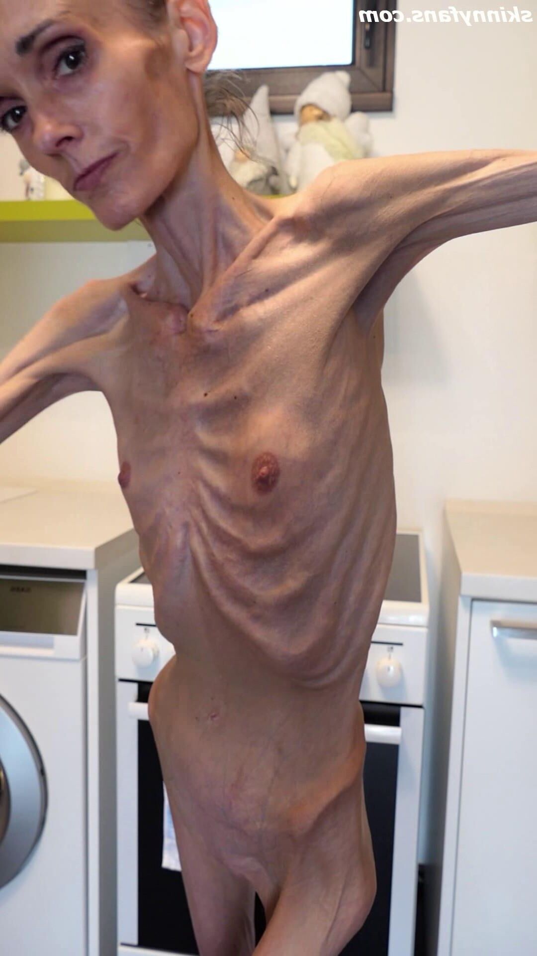 Denisa anoréxica flaca frágil mager duenn knochig huesos