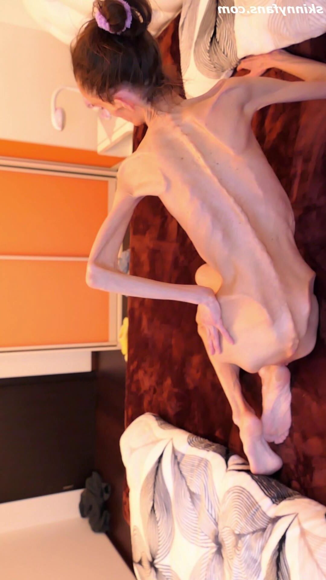 Denisa anoréxica flaca frágil mager duenn knochig huesos