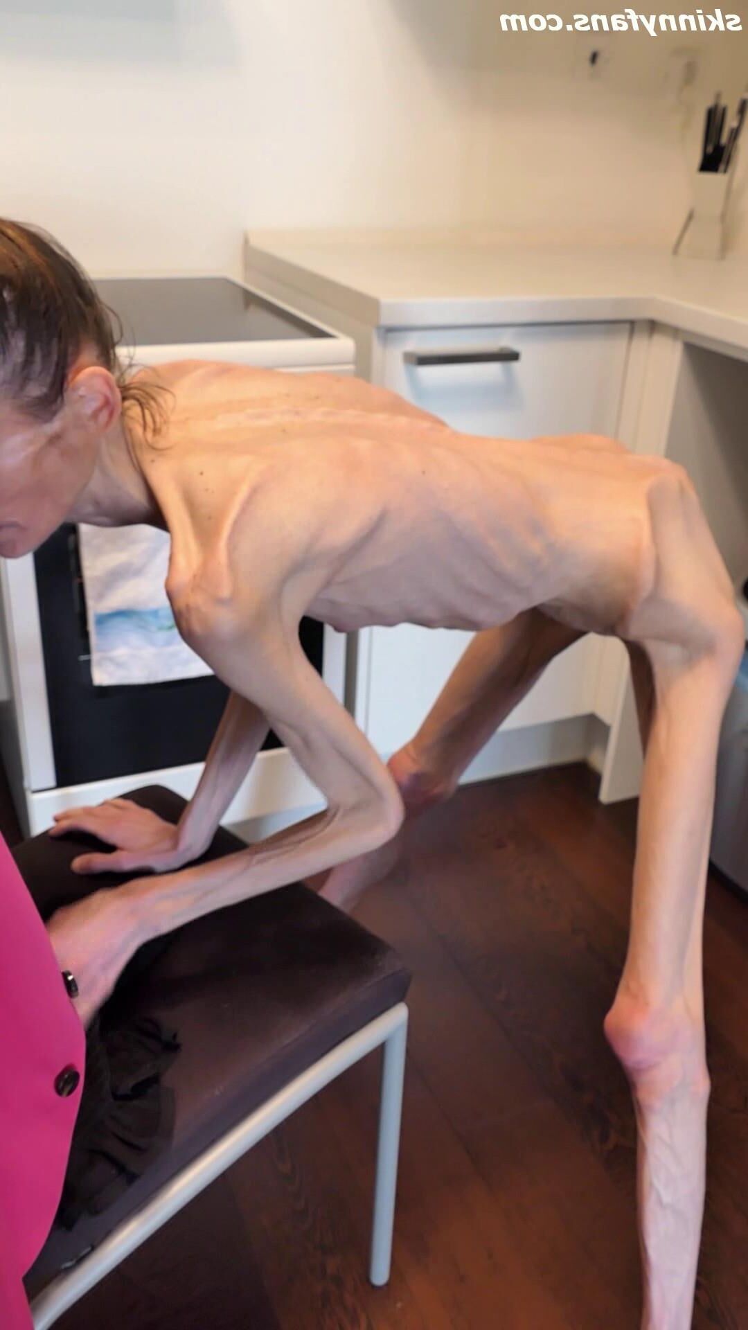 Denisa anoréxica flaca frágil mager duenn knochig huesos