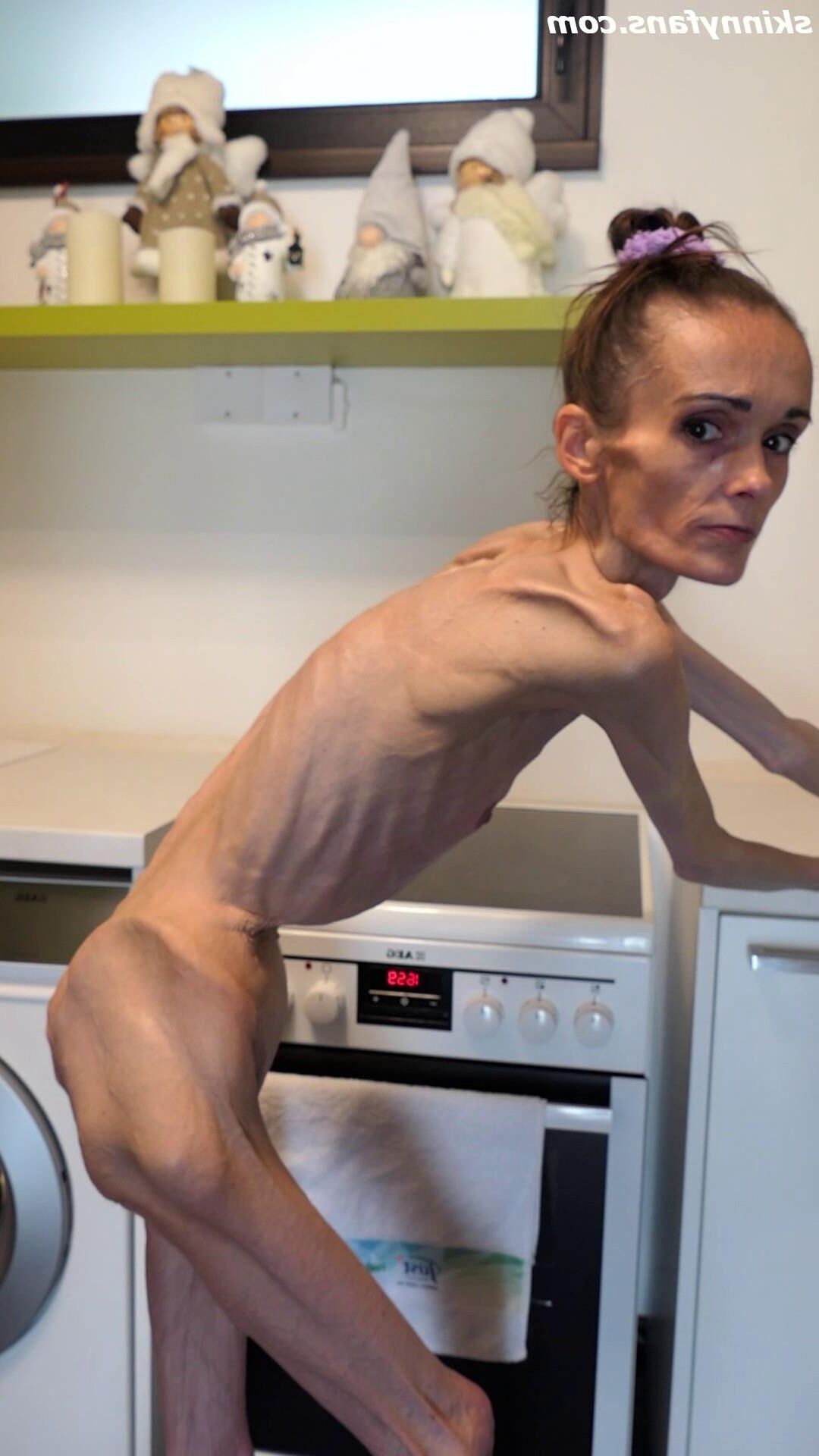 Denisa anoréxica flaca frágil mager duenn knochig huesos