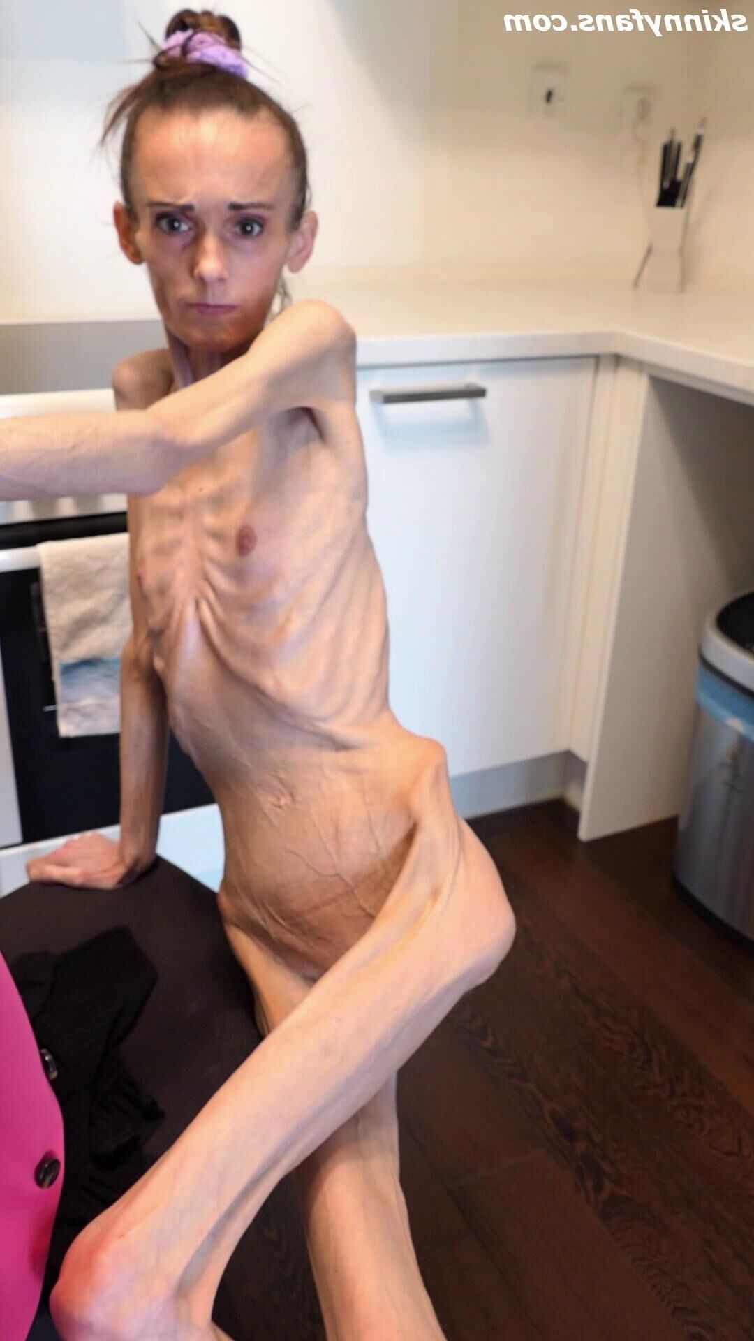 Denisa anoréxica flaca frágil mager duenn knochig huesos