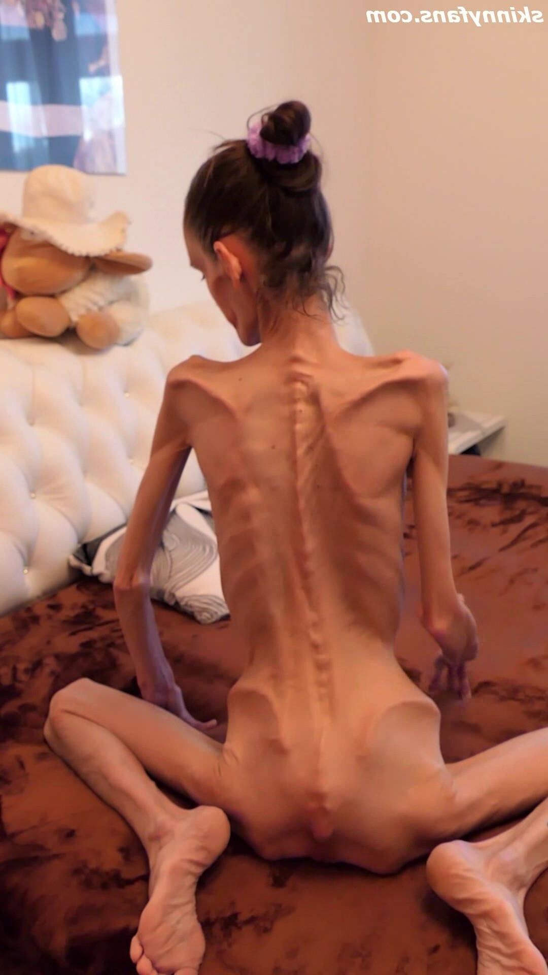 Denisa anoréxica flaca frágil mager duenn knochig huesos
