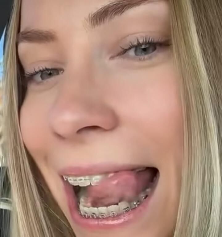Cum on teen braces