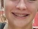 Cum on teen braces