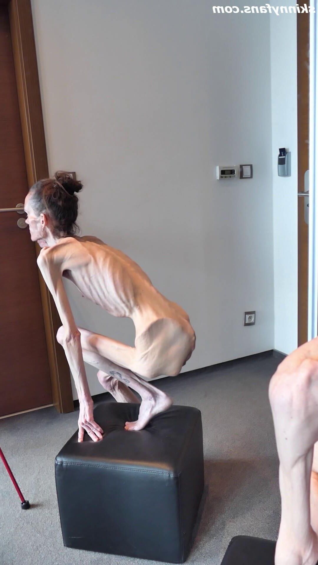 Denisa magersüchtig
