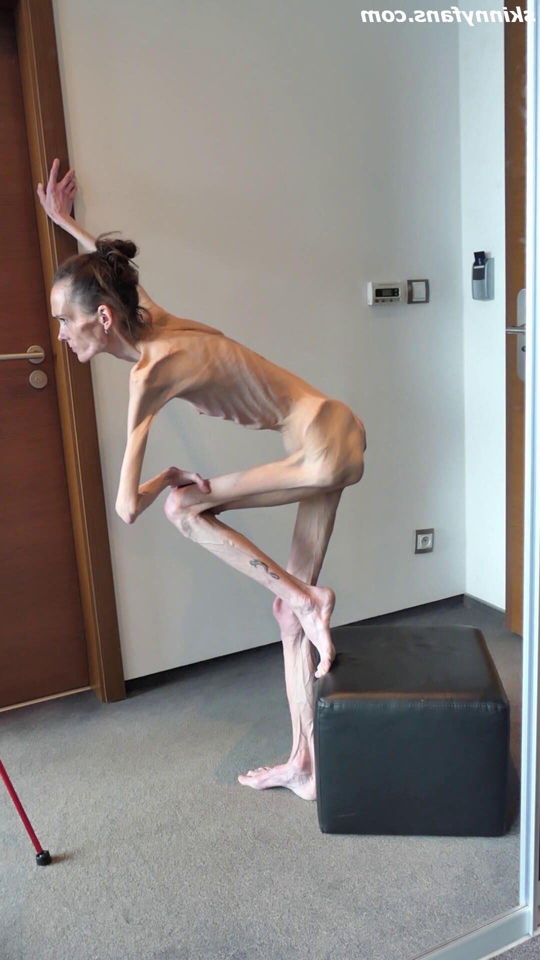 Denisa magersüchtig