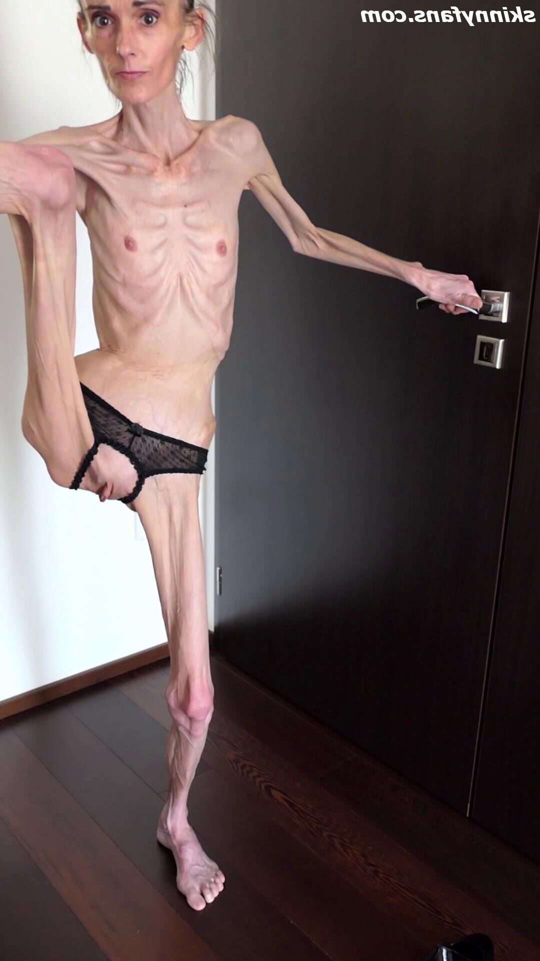 Denisa magersüchtig