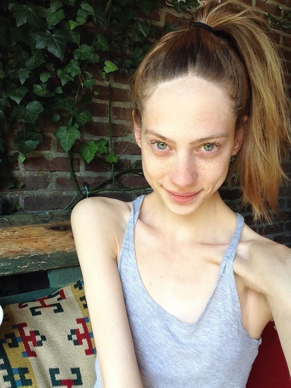 Skinny 