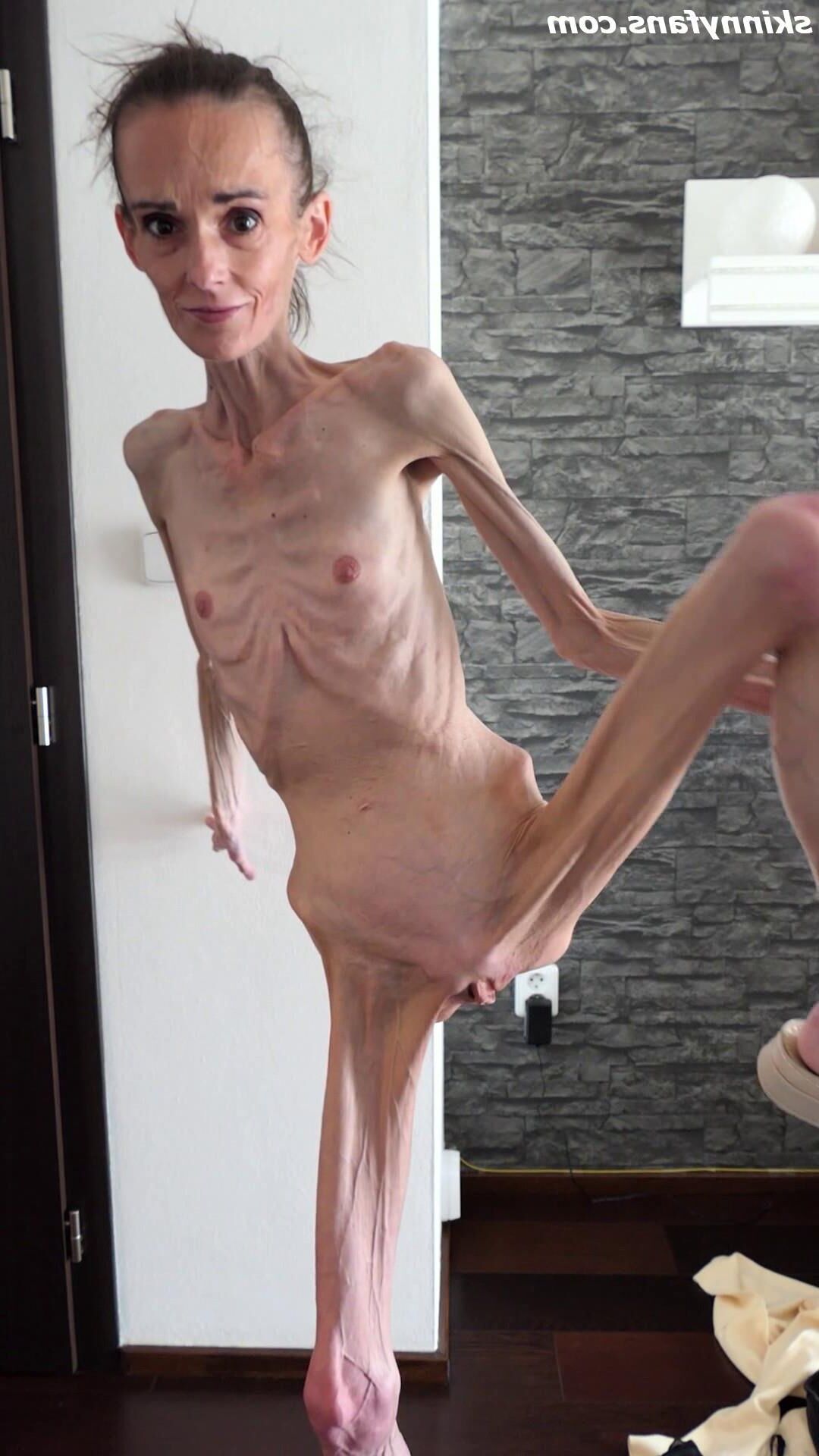 Denisa anorexic skinny fragile mager duenn knochig bones 
