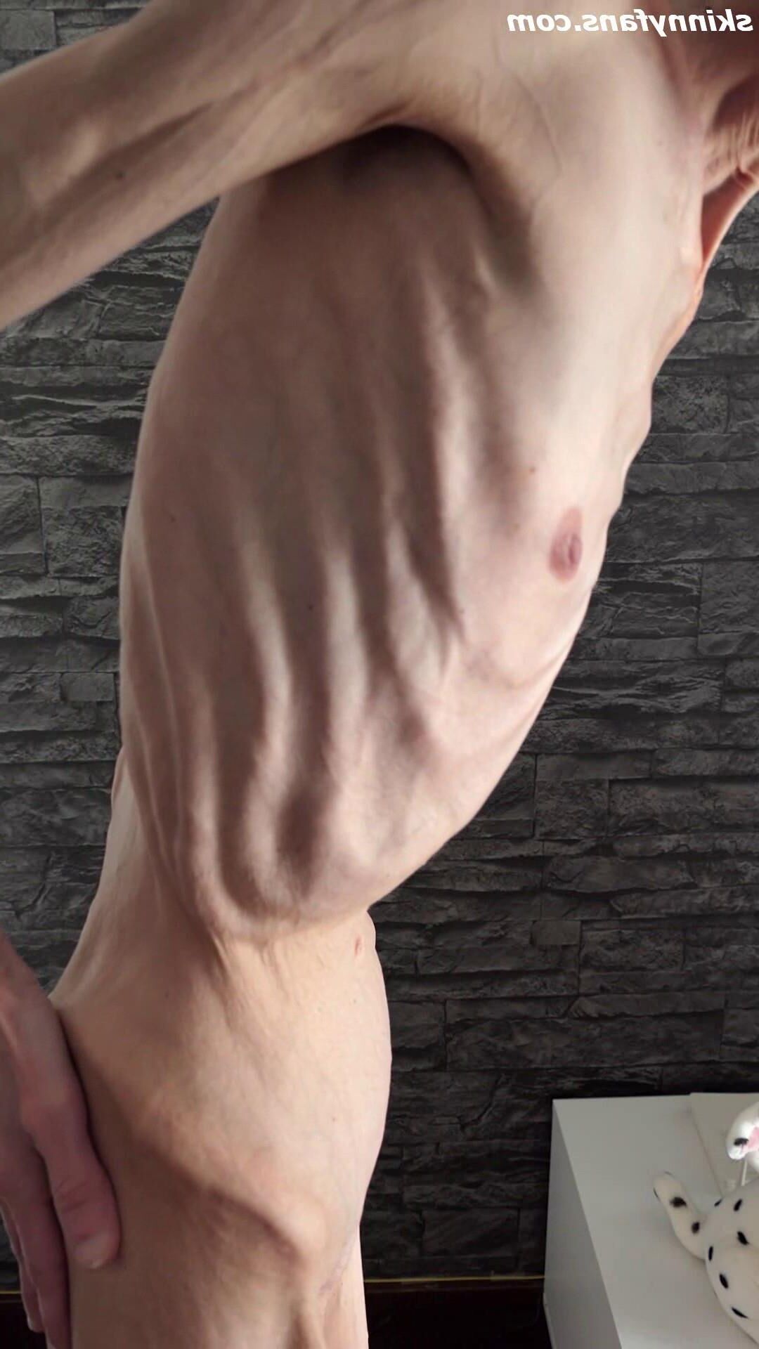 Denisa anorexic skinny fragile mager duenn knochig bones 
