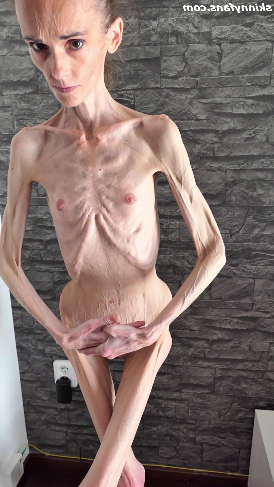 Denisa anorexic skinny fragile mager duenn knochig bones 