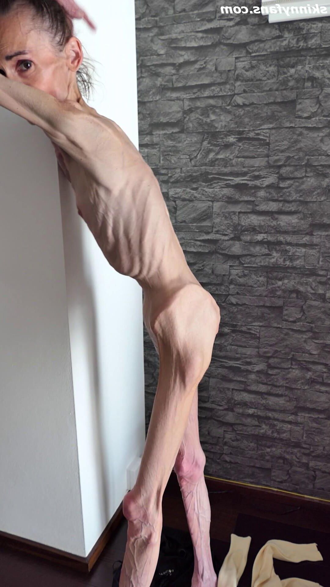 Denisa anorexic skinny fragile mager duenn knochig bones 
