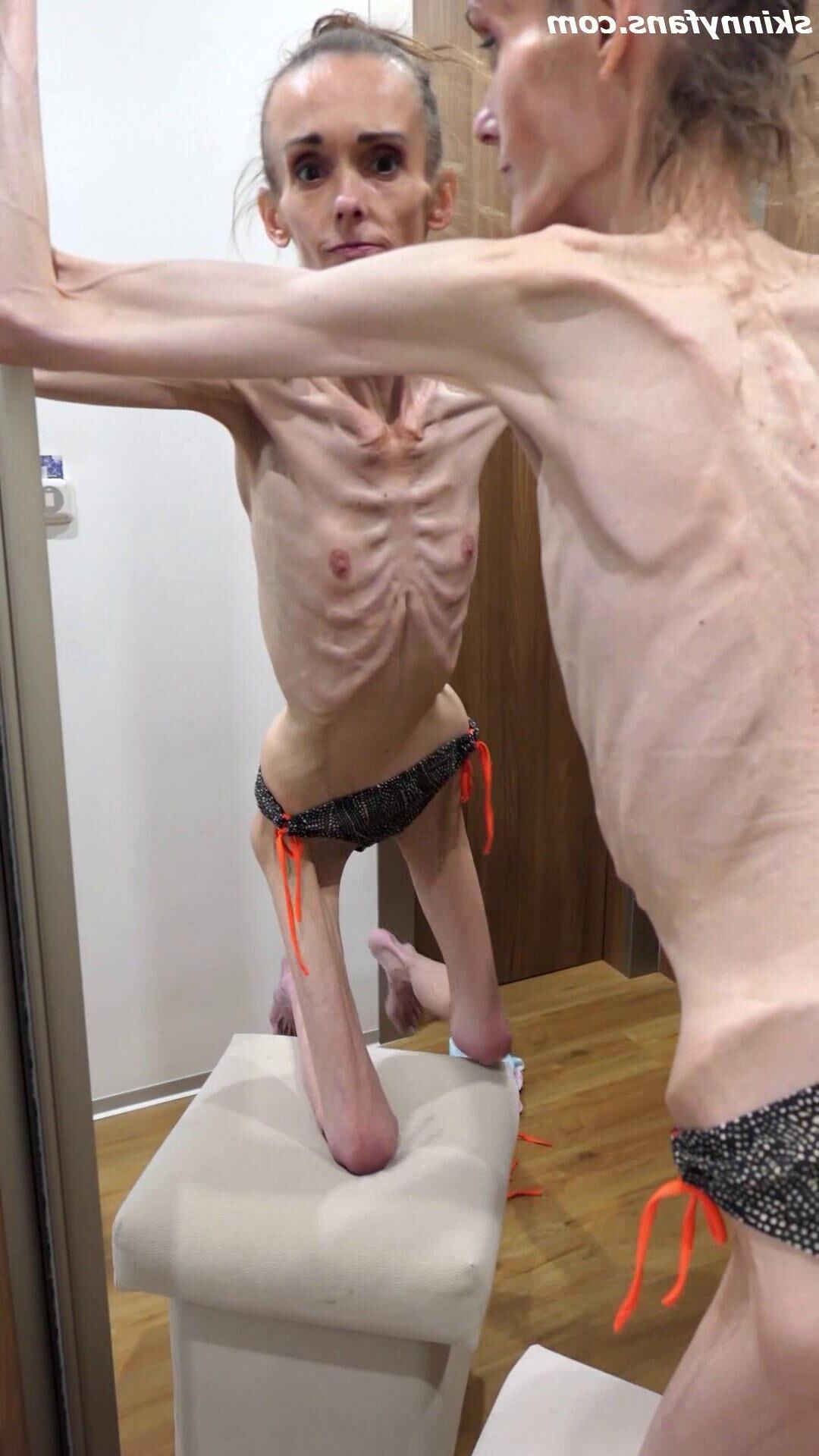 Denisa anorexic skinny fragile mager duenn knochig bones 