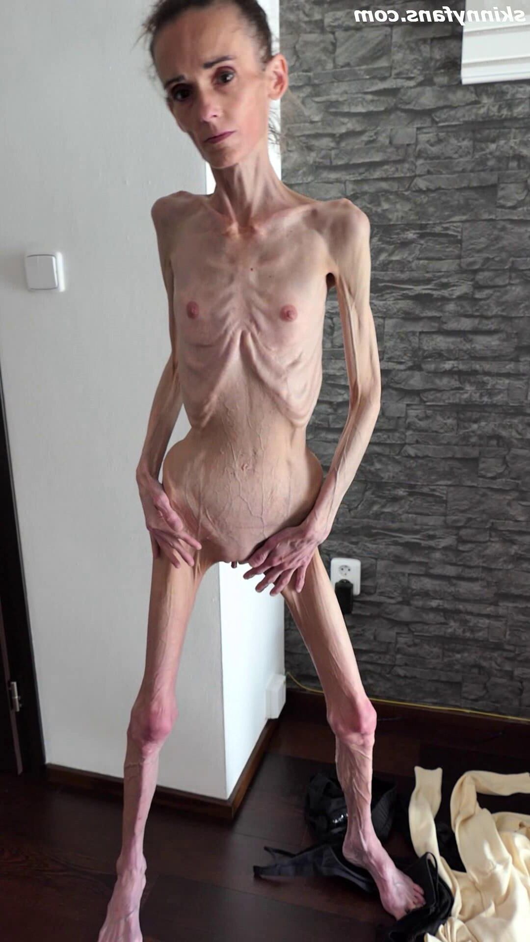 Denisa anorexic skinny fragile mager duenn knochig bones 
