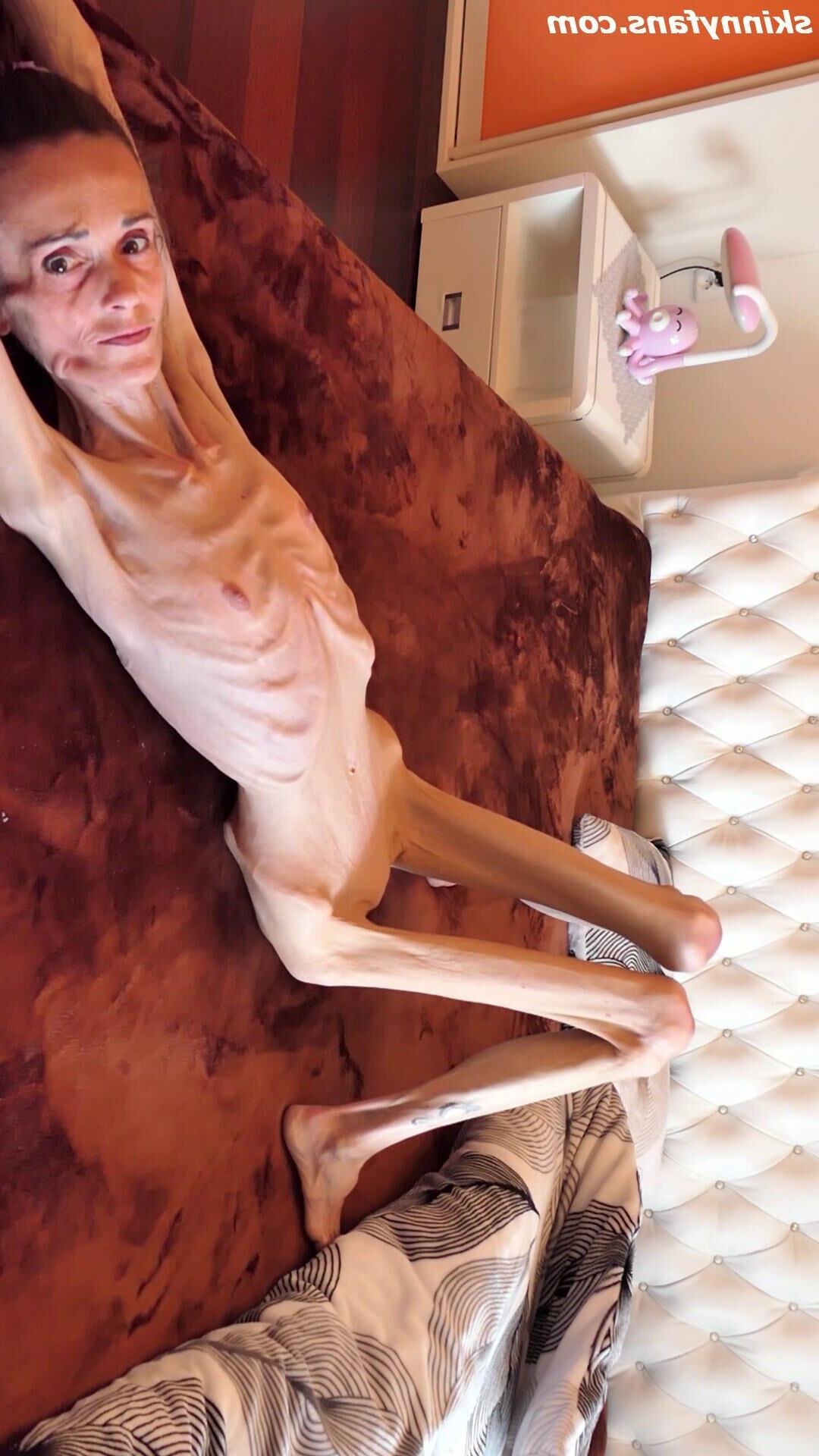Denisa anorexic skinny fragile mager duenn knochig bones 