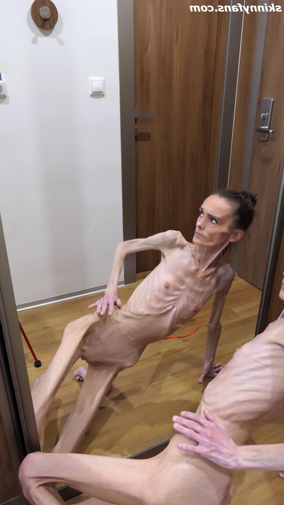 Denisa anorexic skinny fragile mager duenn knochig bones 