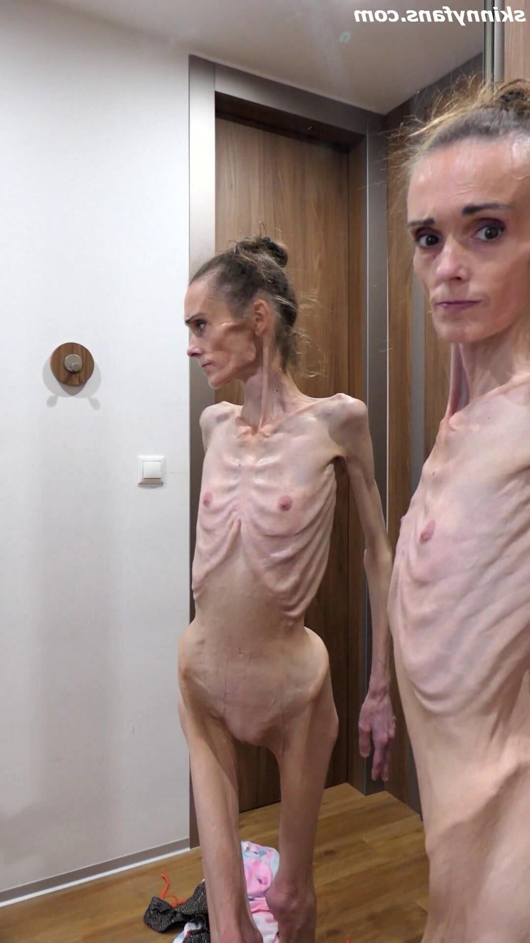 Denisa anorexic skinny fragile mager duenn knochig bones 