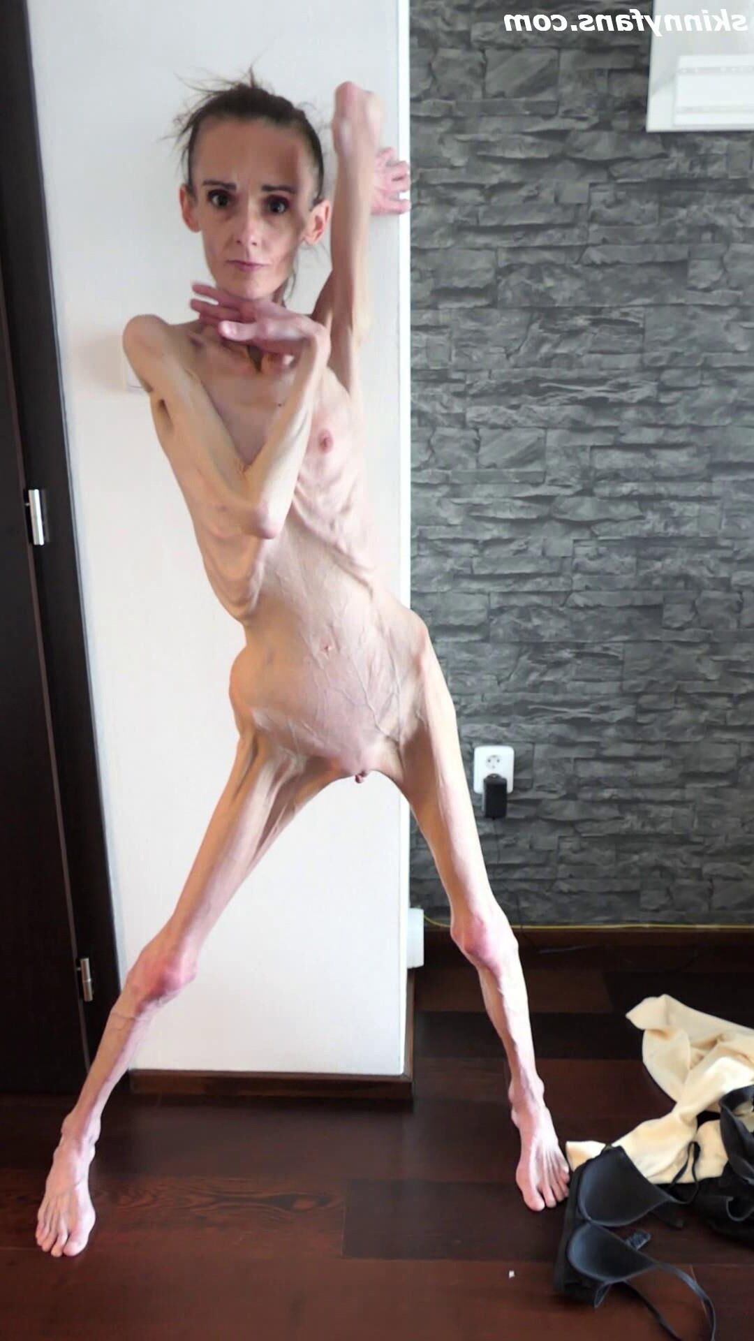Denisa anorexic skinny fragile mager duenn knochig bones 