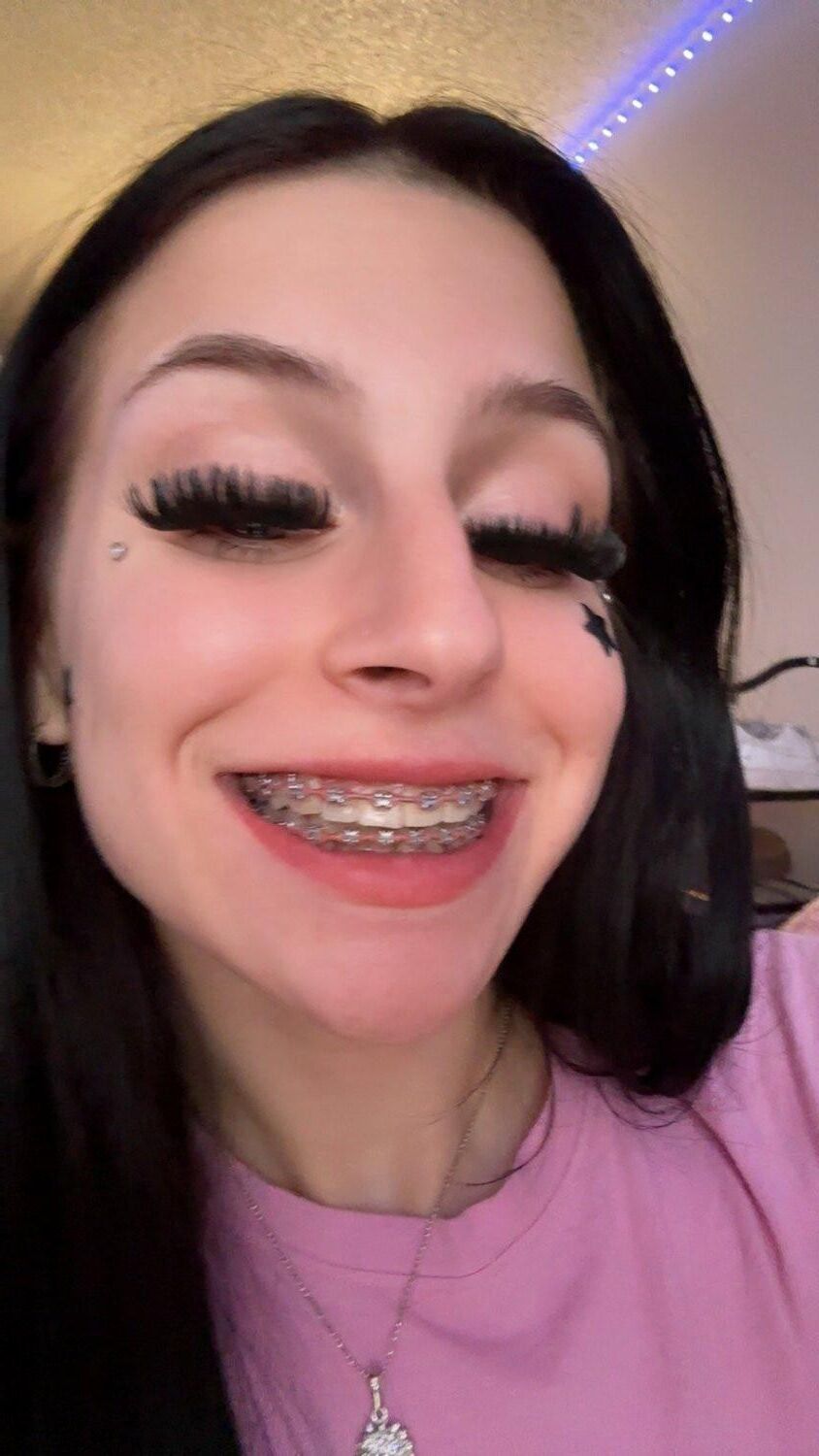 yr old braceface slut