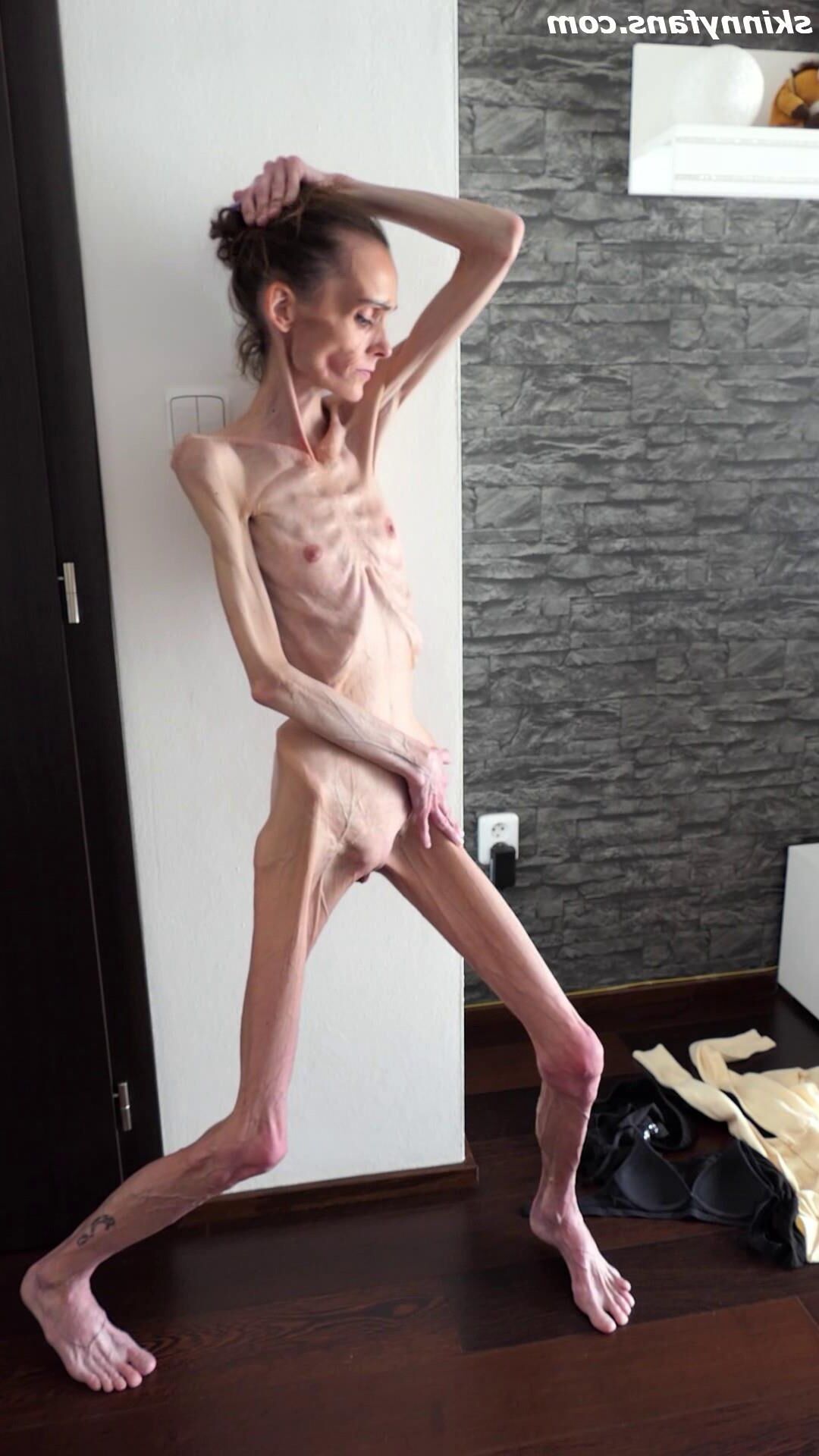 Denisa anorexic skinny fragile mager duenn knochig bones 