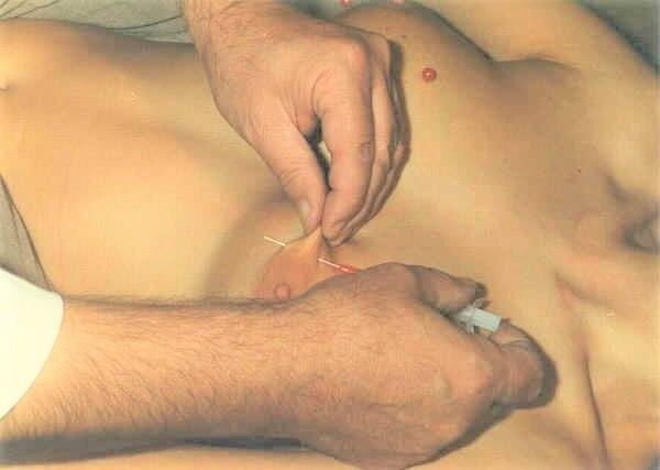 Jeyer's Soft Needle Play