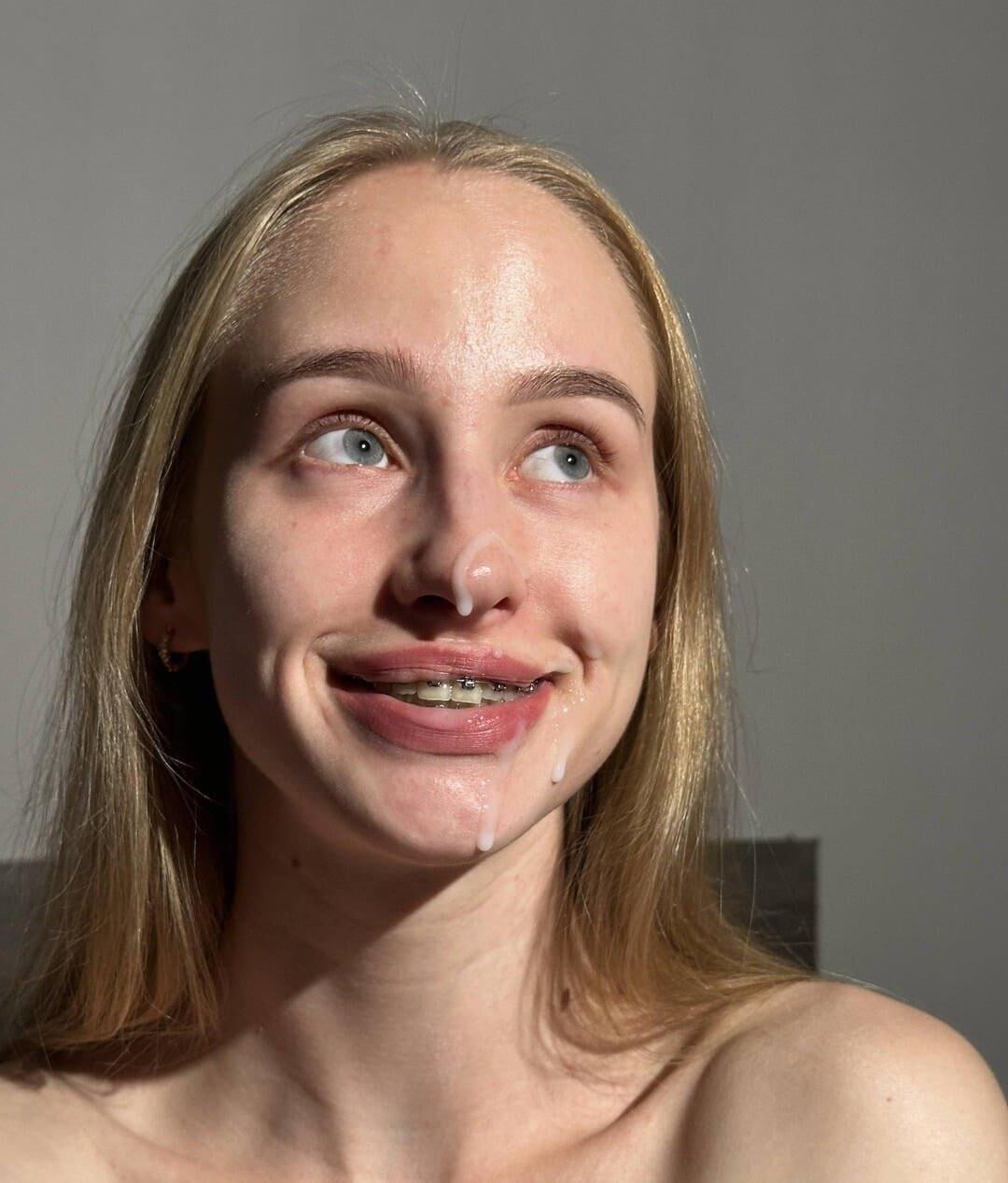 Brace Face