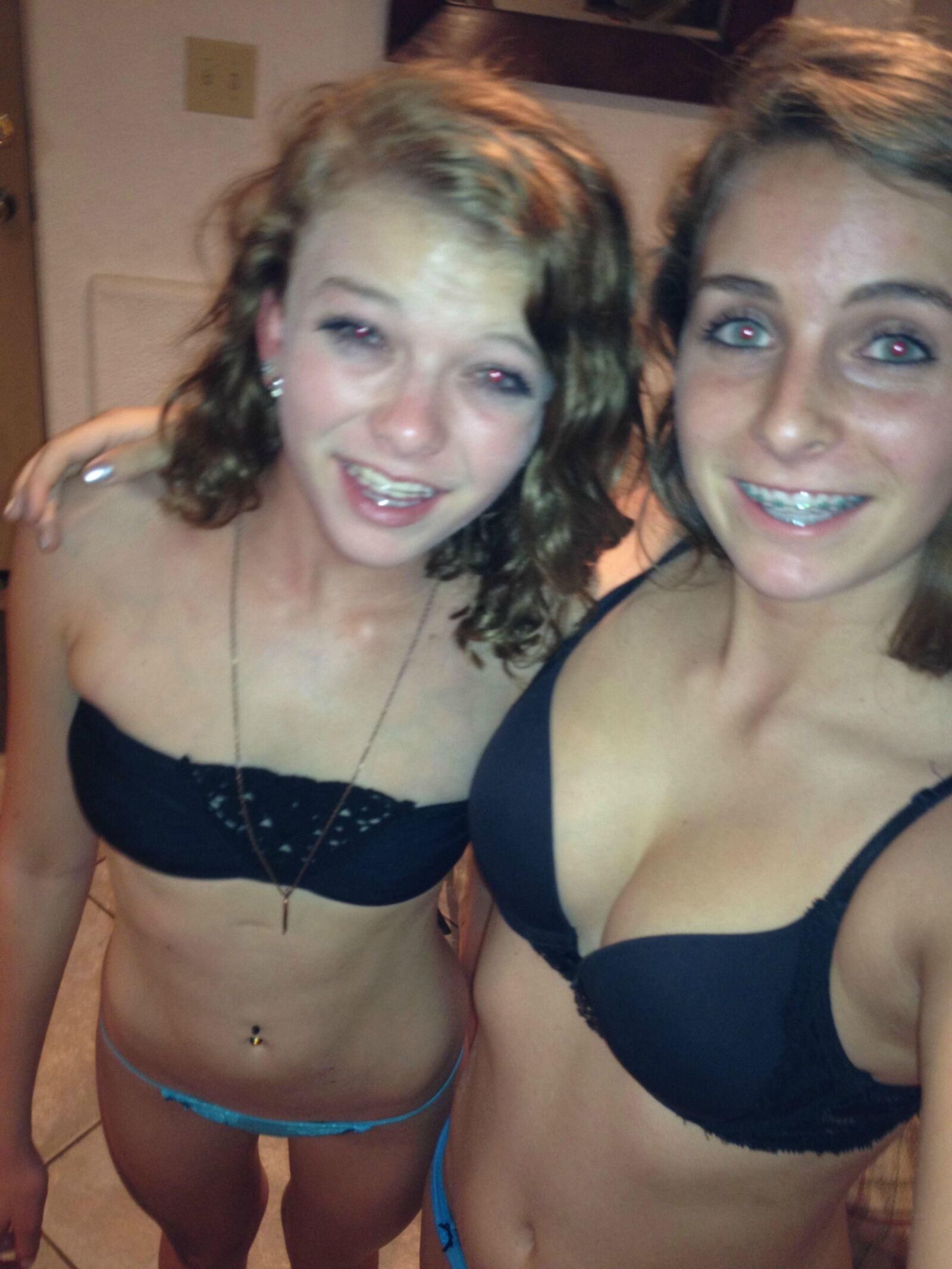 Brace Face
