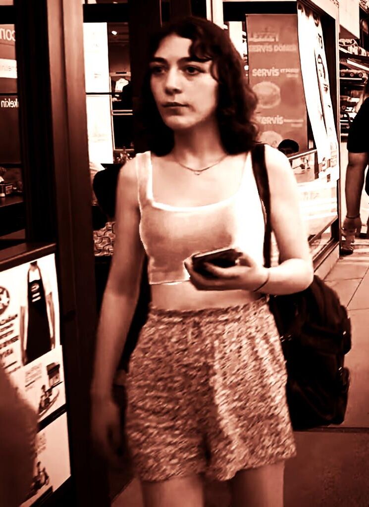 Her bra has failed! (X Ray!)