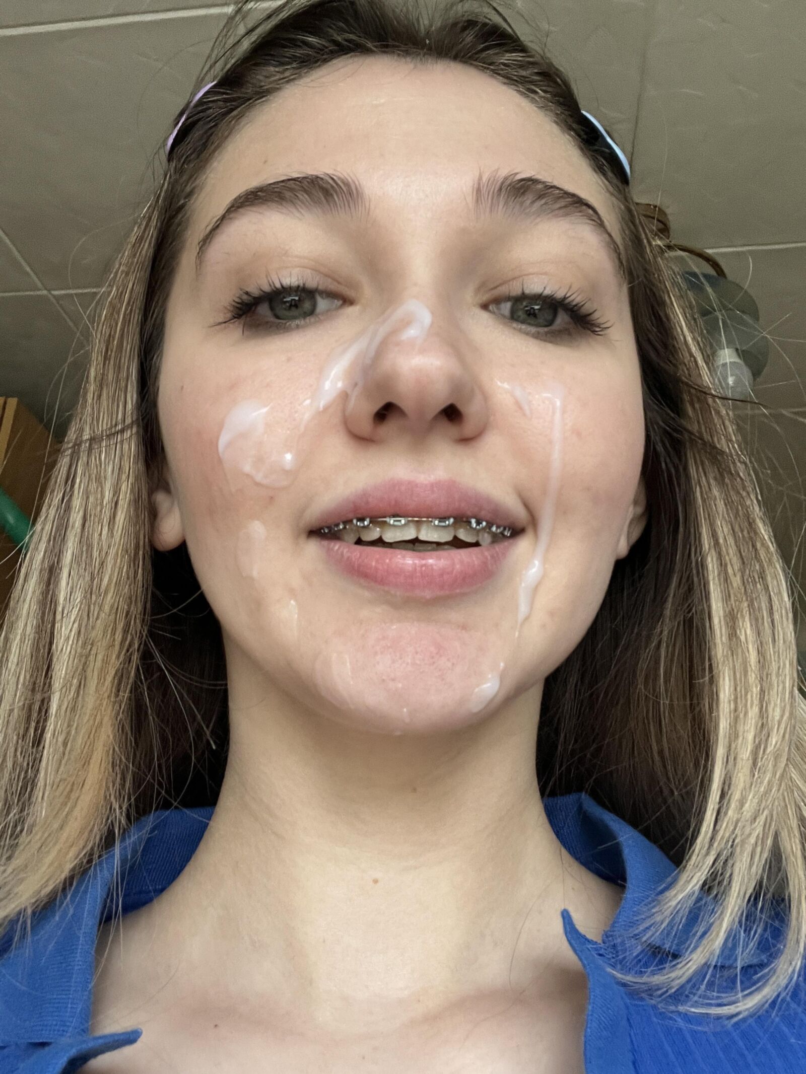 Brace Face