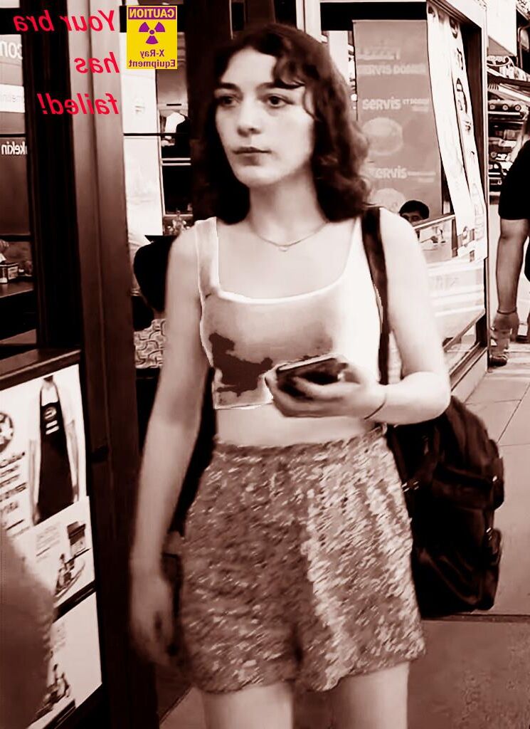 Her bra has failed! (X Ray!)