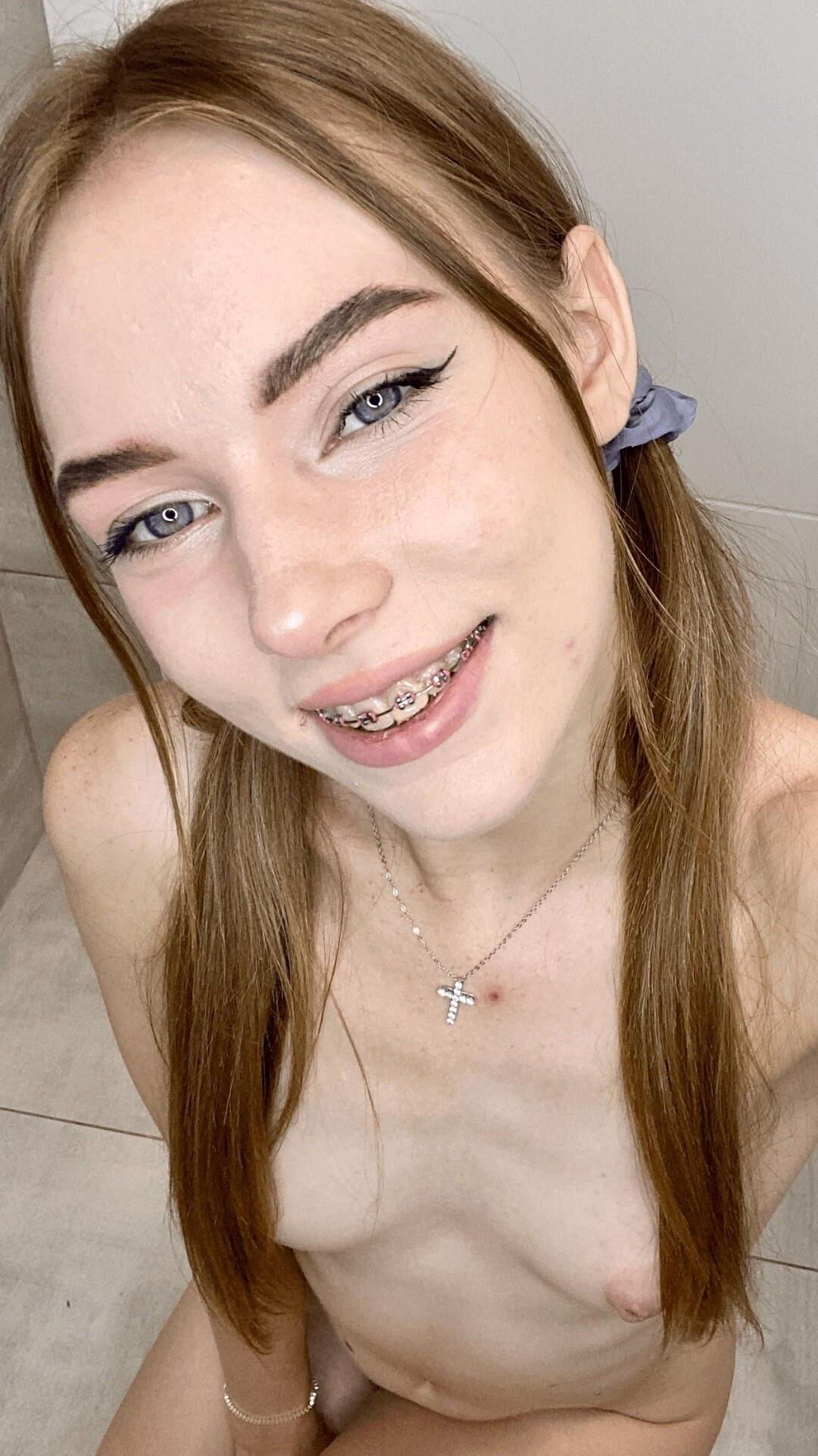 Brace Face