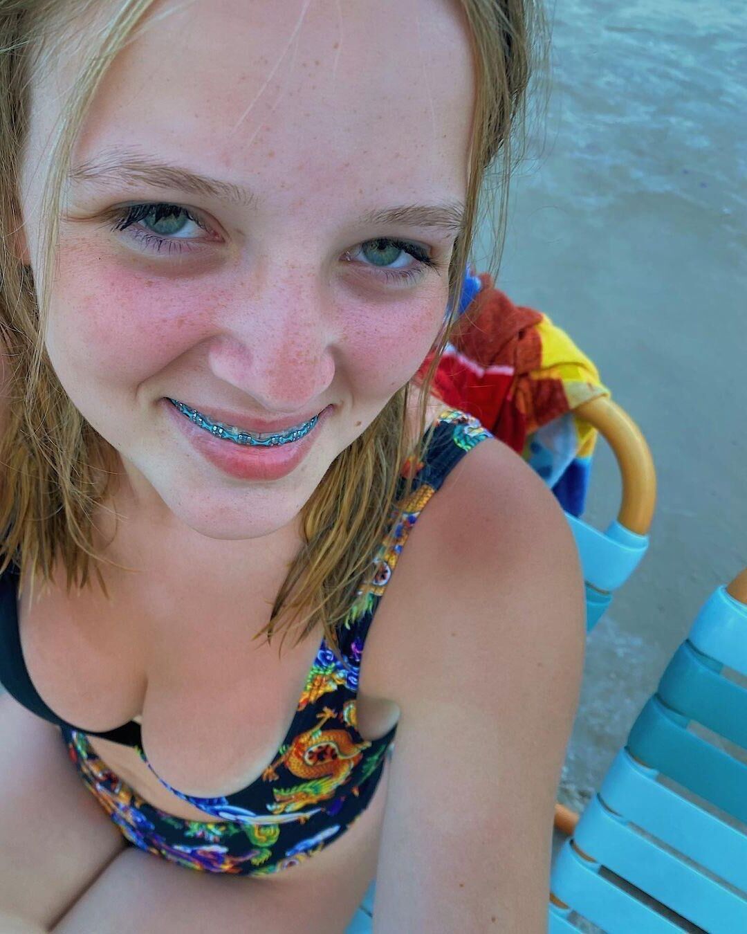 Brace Face