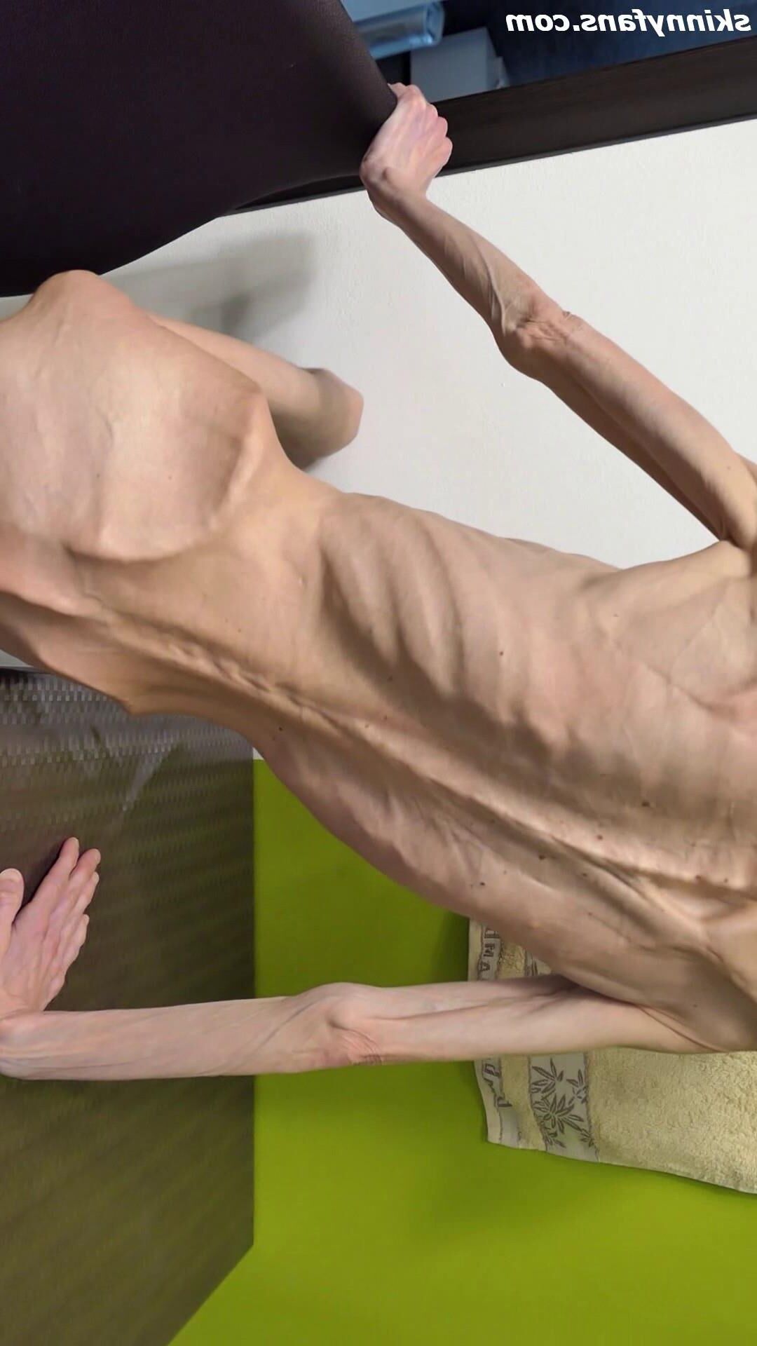 Denisa anorexique maigre maigre mageur Duenn Knochig Bones