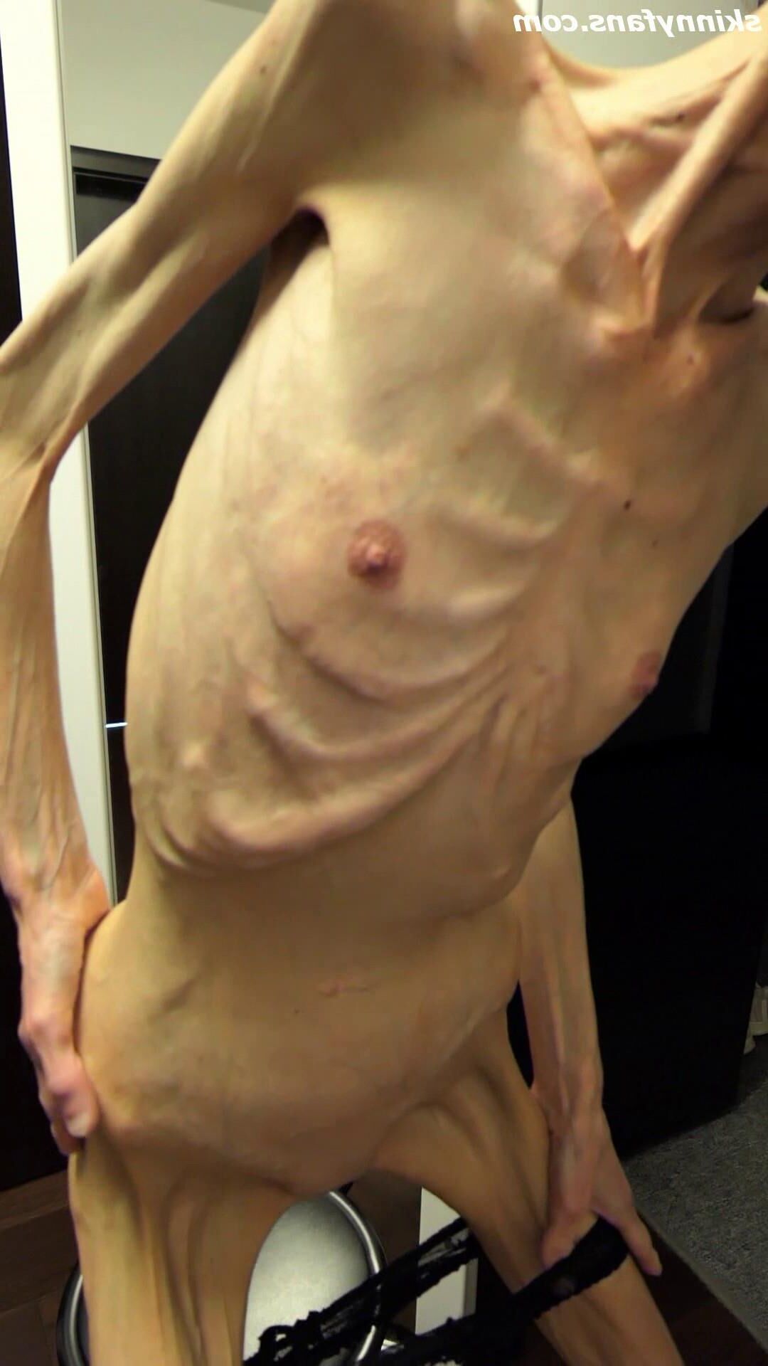 Denisa anorexique maigre maigre mageur Duenn Knochig Bones