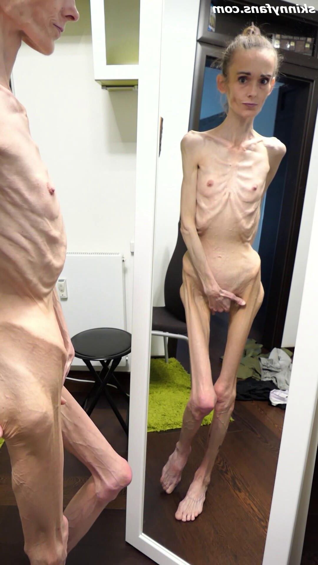 Denisa anorexique maigre maigre mageur Duenn Knochig Bones