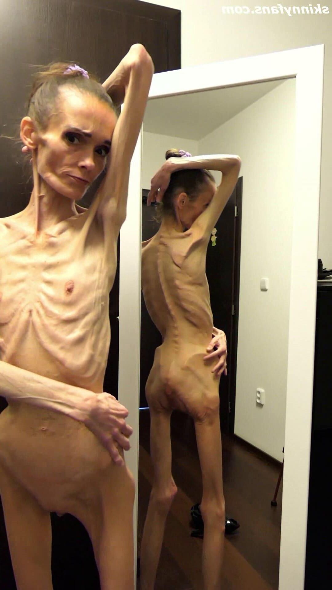 Denisa anorexique maigre maigre mageur Duenn Knochig Bones