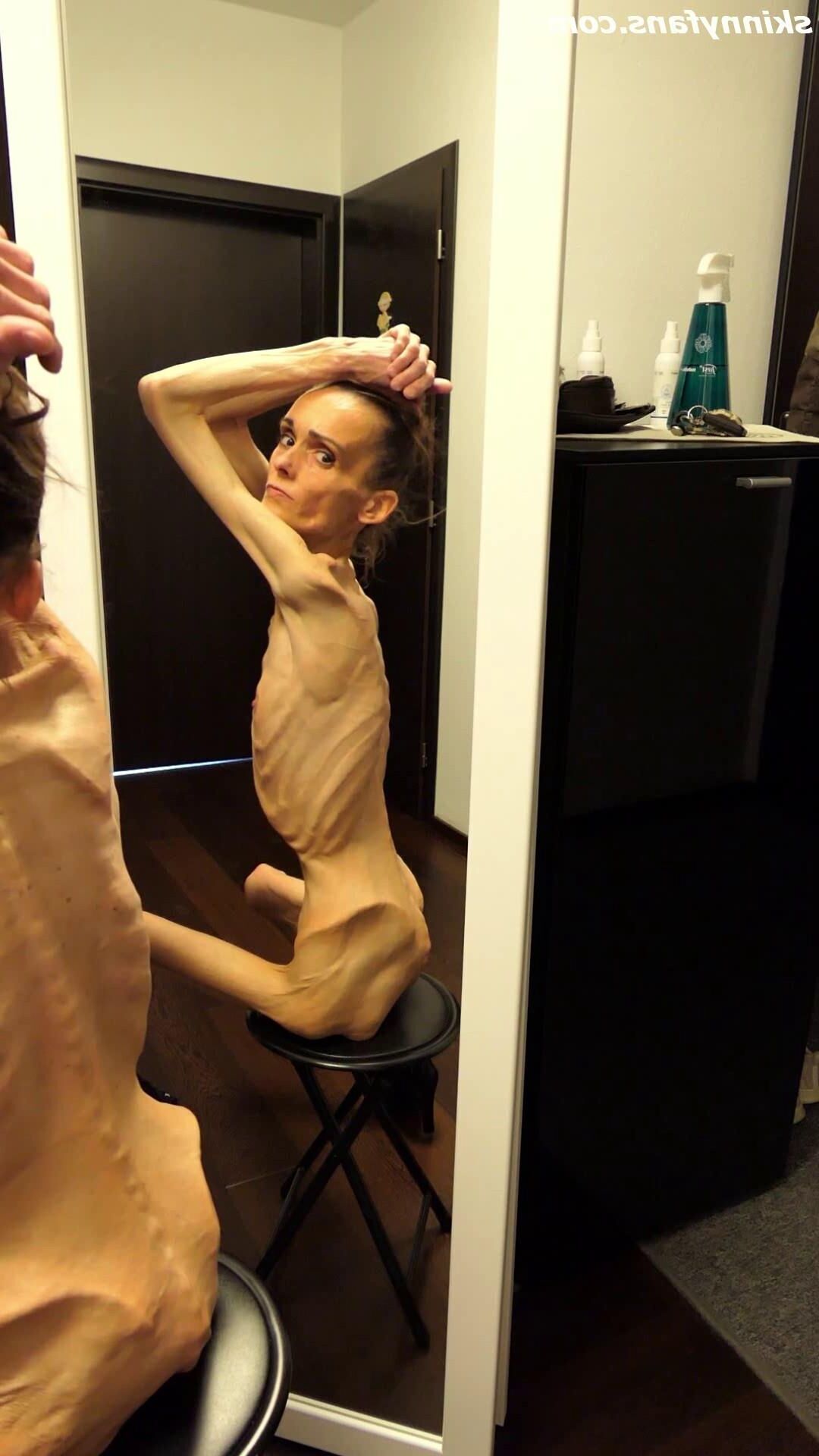 Denisa anorexique maigre maigre mageur Duenn Knochig Bones