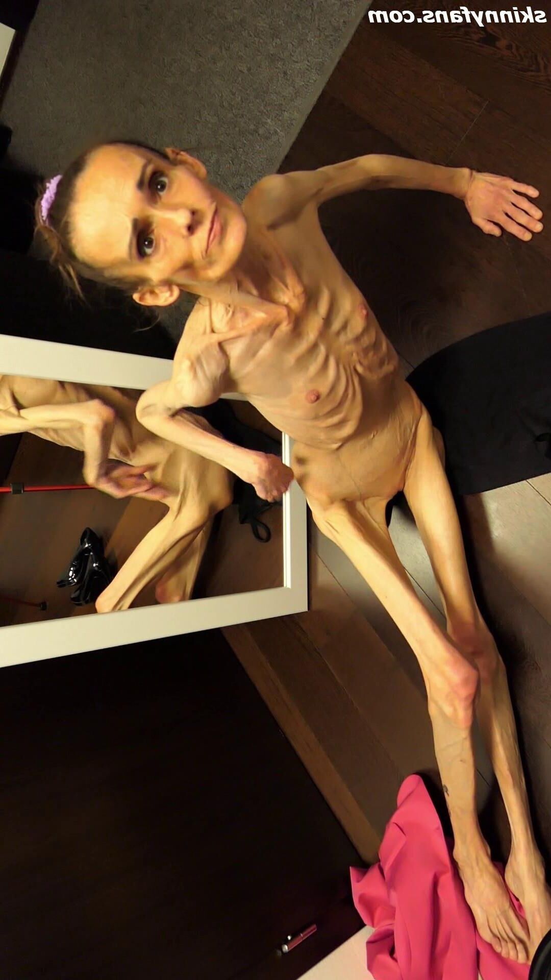 Denisa anorexique maigre maigre mageur Duenn Knochig Bones
