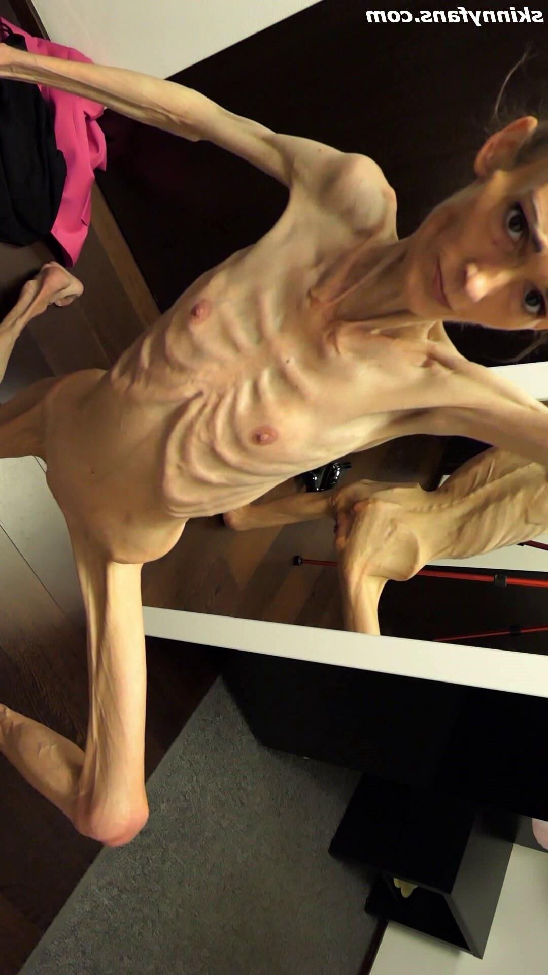 Denisa anorexique maigre maigre mageur Duenn Knochig Bones