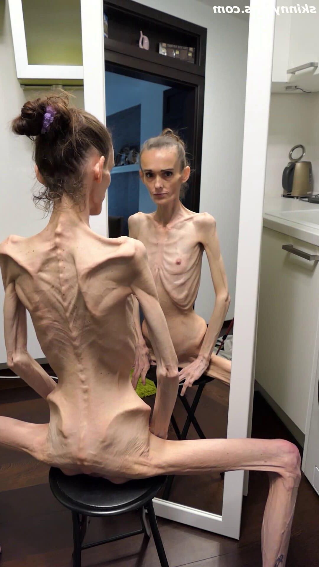 Denisa anorexique maigre maigre mageur Duenn Knochig Bones
