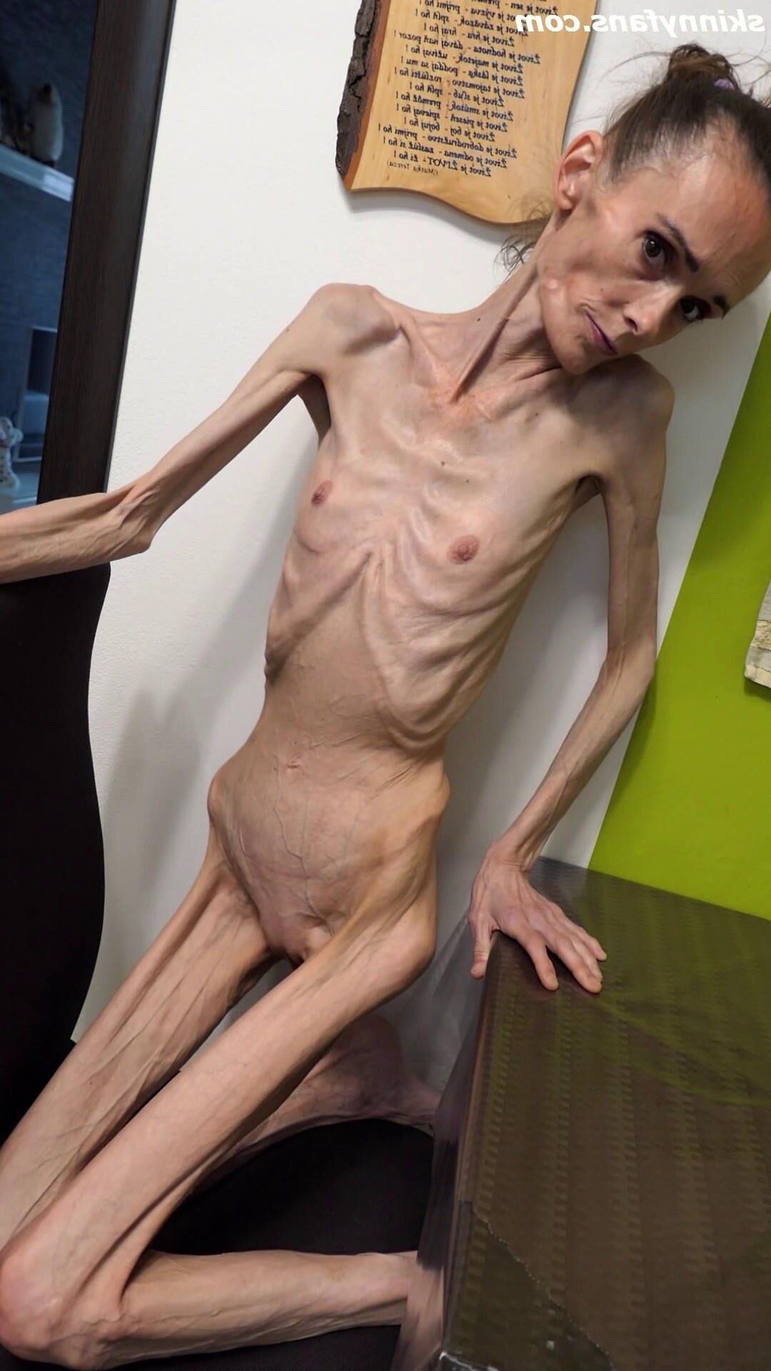 Denisa anorexique maigre maigre mageur Duenn Knochig Bones