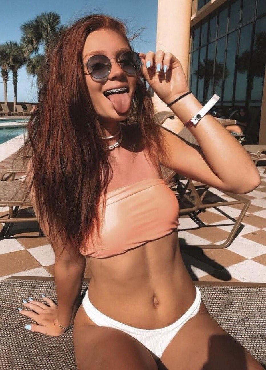 Braces 