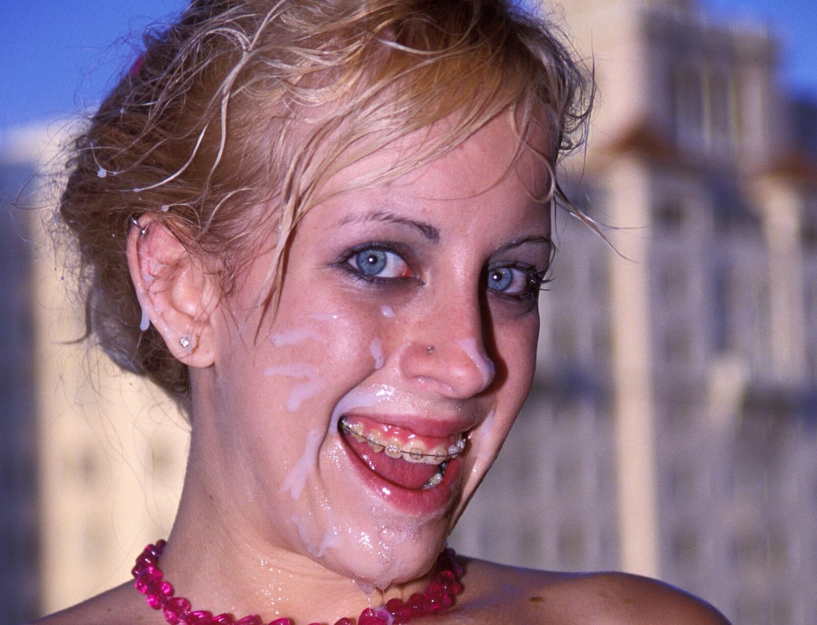 Braces 